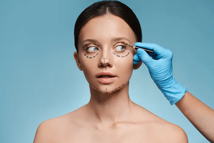 Blepharoplasty - Myths, Recovery Time, and Cost Revealed