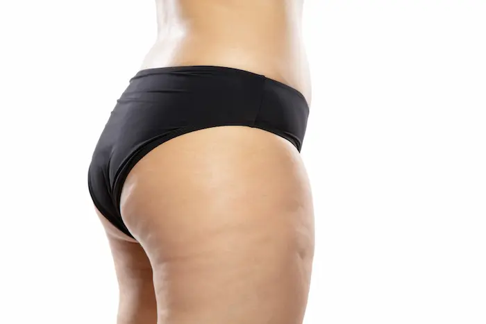 Essential Tips: Preparing for Buttock Enhancement