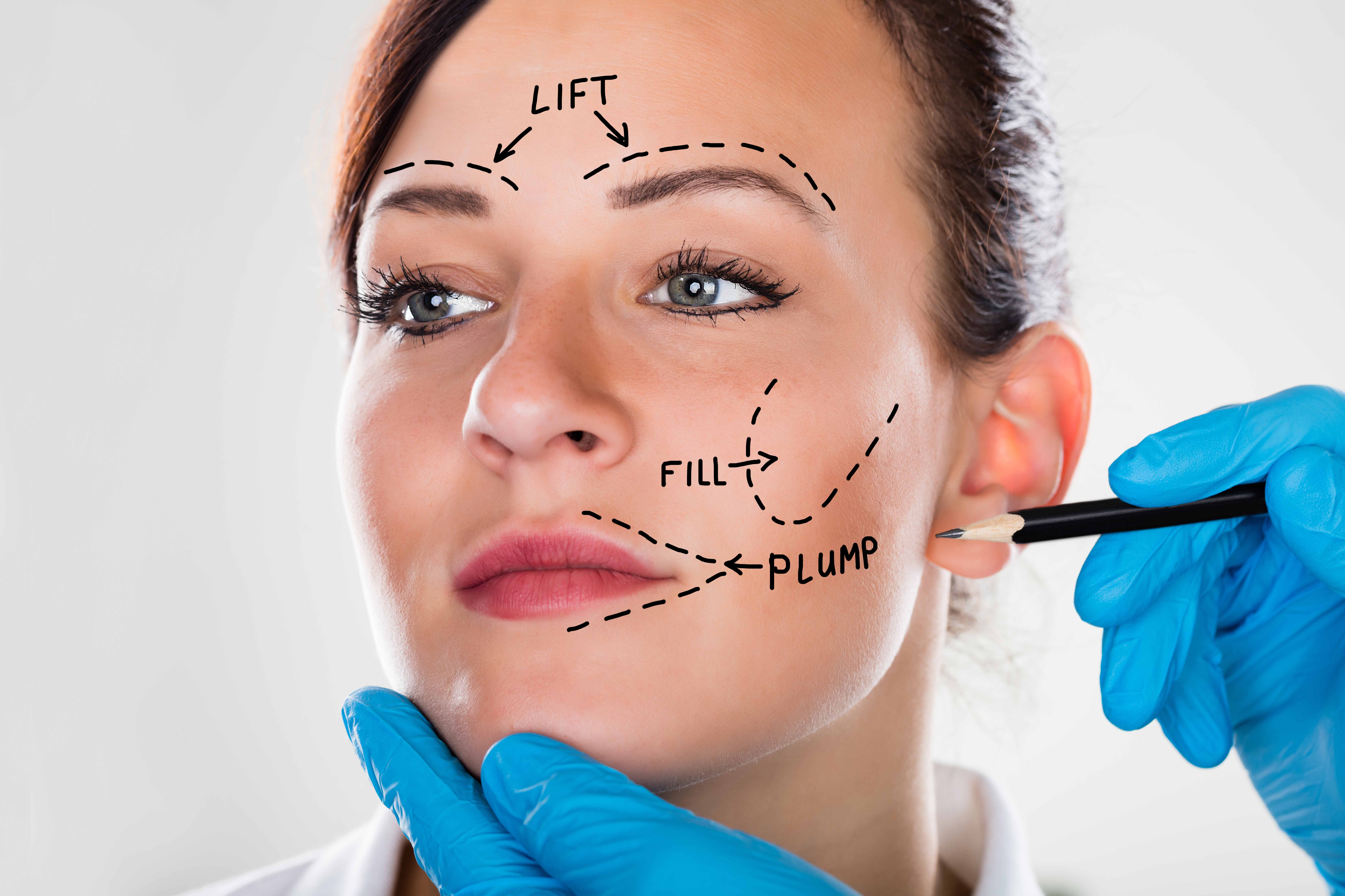 Phenomenal Facts about Facelift Surgery