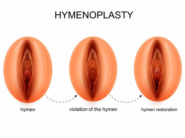Some Myths & Surprising Facts of hymen and virginity