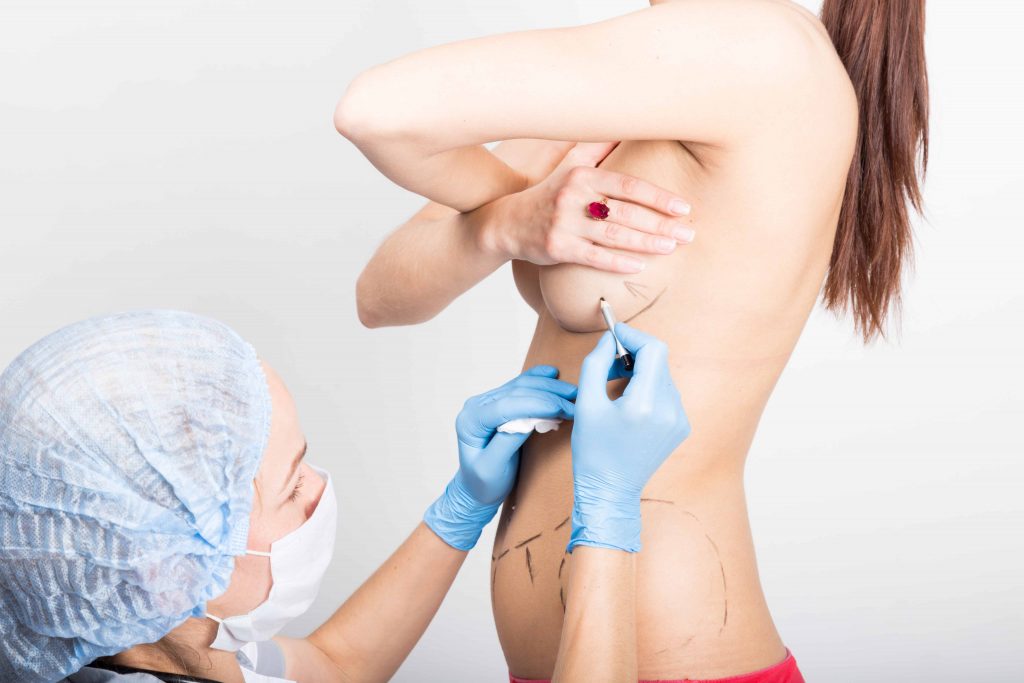 Top 10 Myths about Breast Lift Surgery Busted