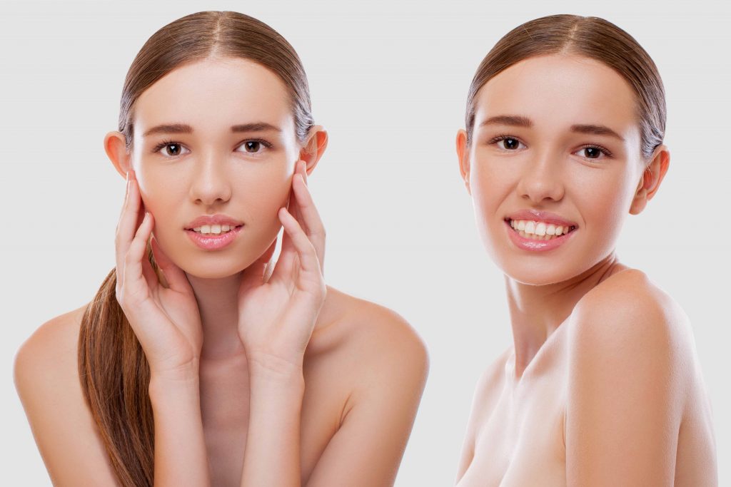 Specific Tips To Speed Up Otoplasty Recovery